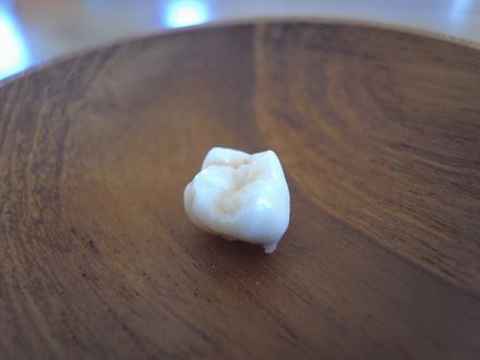 babytooth2.jpg