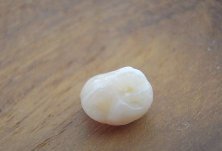 tooth2013-11.jpg